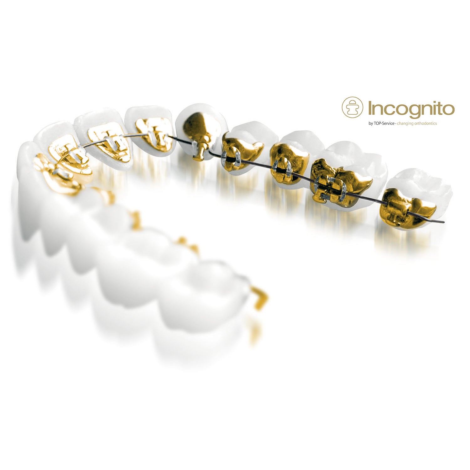 Incognito Lingual Bracket System - Mary Lo